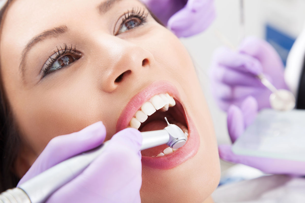 La Réduction Interproximale (IPR) pour Invisalign : Le Guide Complet