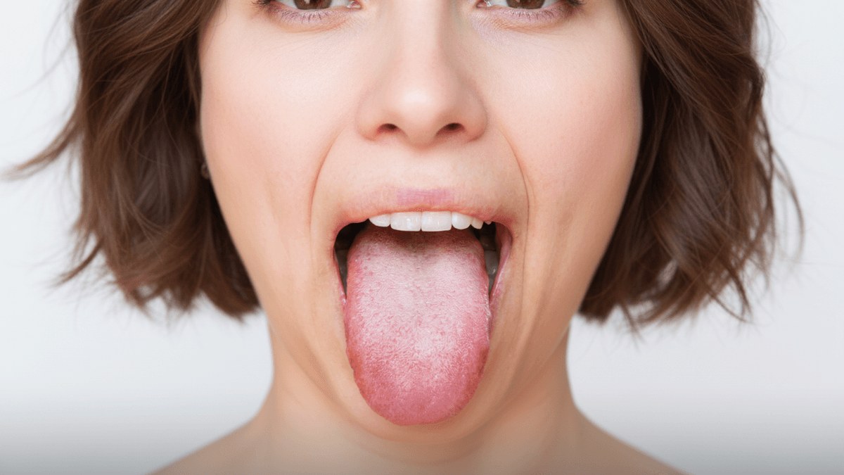 Langue Blanche, Noire ou Jaune : Causes et Solutions