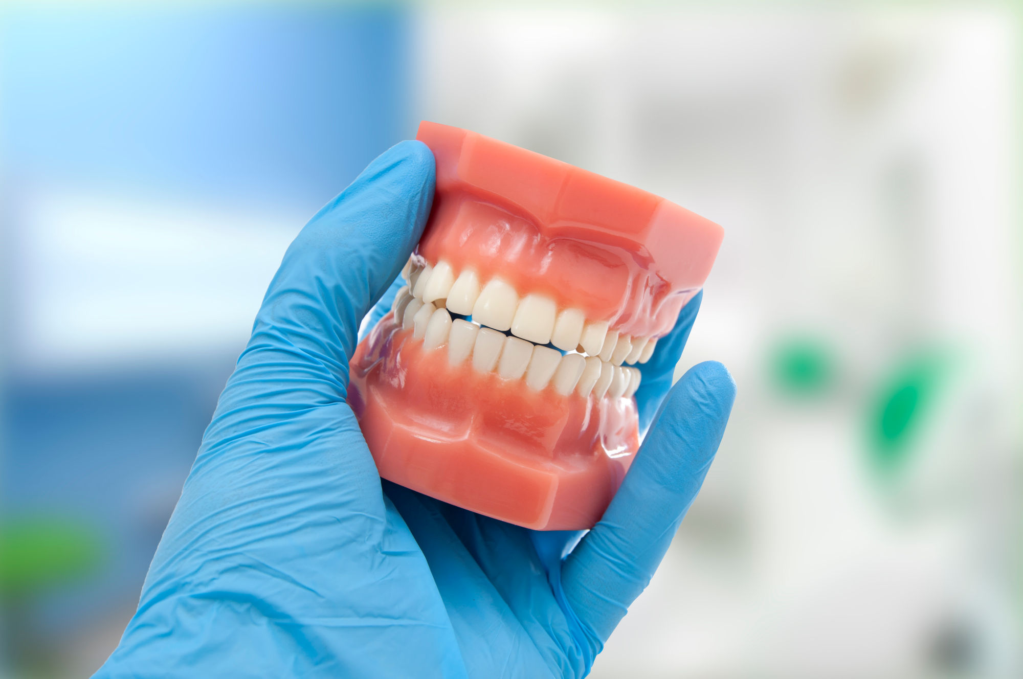 Occlusion Dentaire : Définition, Troubles et Traitements