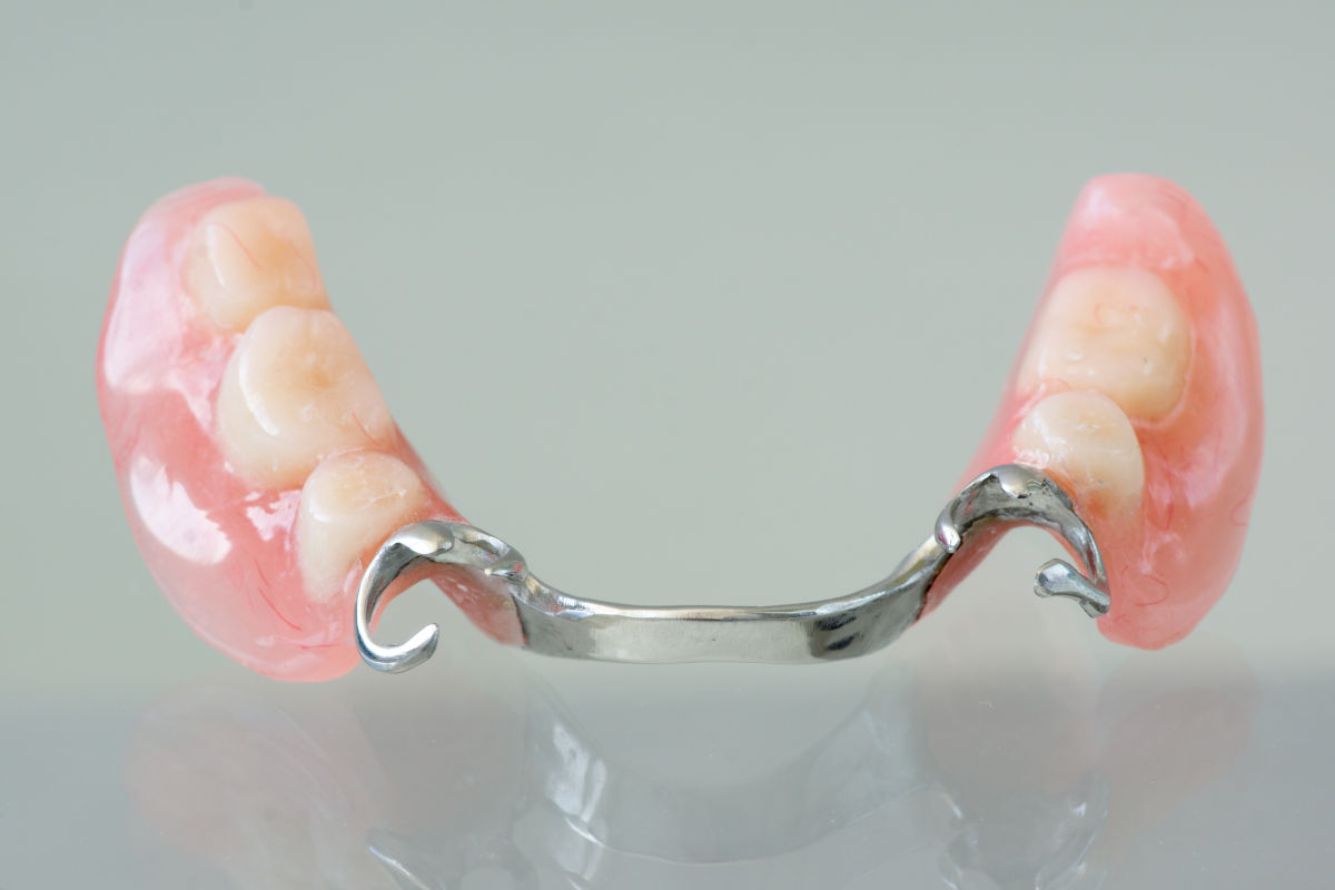 Valplast Denture: Cost, Benefits & Care